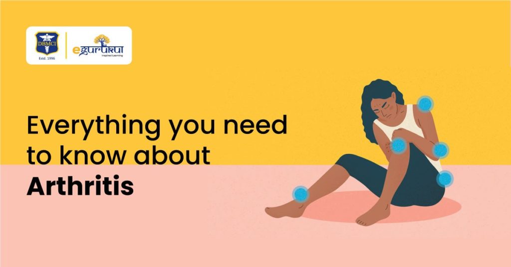 Everything you need to know about arthritis 