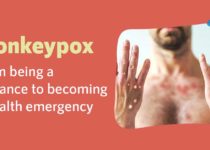 monkeypox